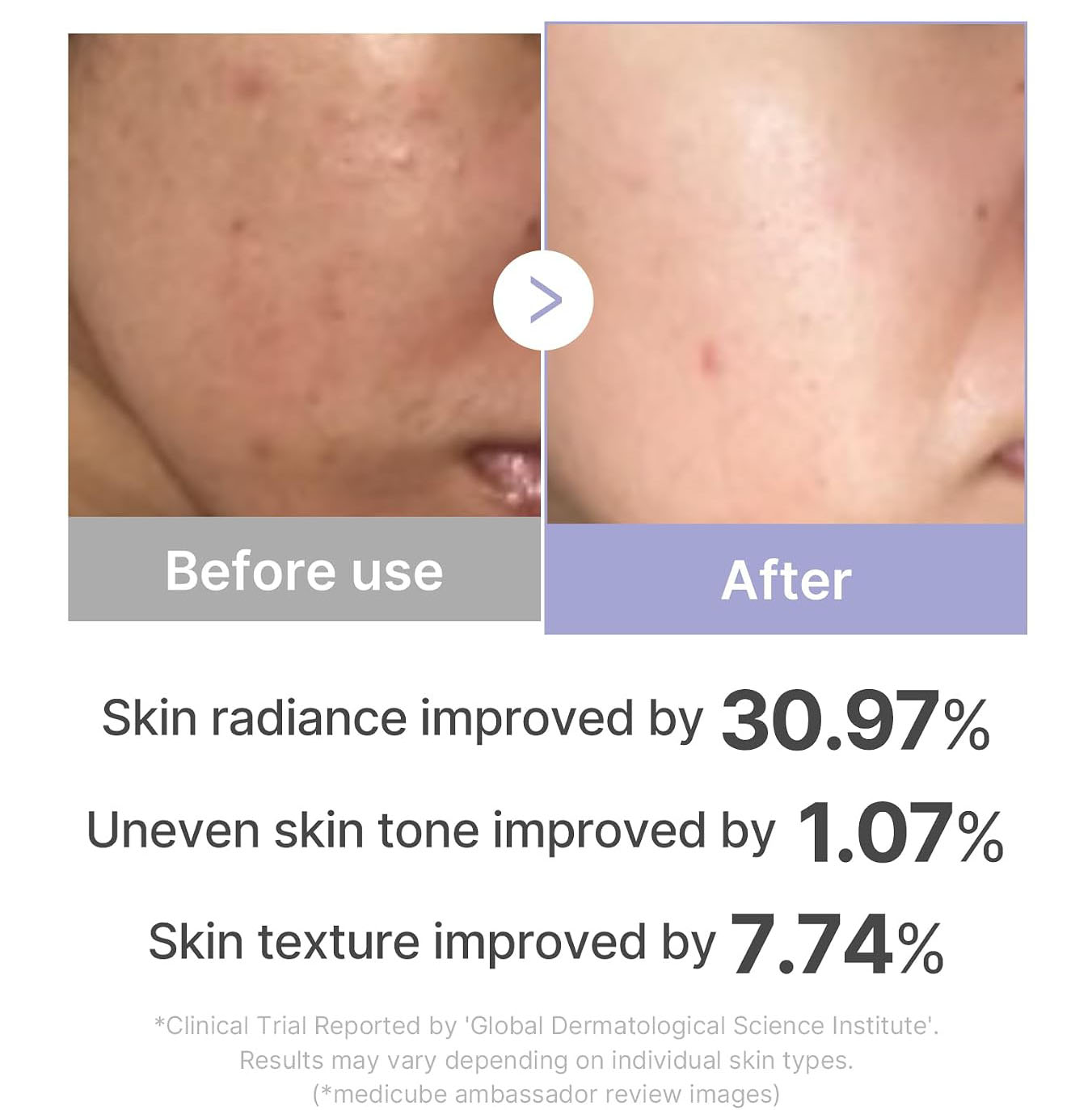 Medicube Booster Pro Mini clinical trial results: 30.97% radiance, 1.07% tone, 7.74% texture improvement after immediate use.